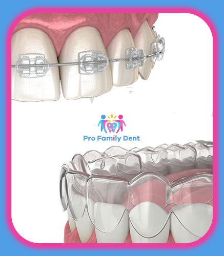 Aparate Dentare Safir Invizibile Invisalign Targu Neamt Oferta Pret Pareri - Servicii Clinica Pro Family Dent