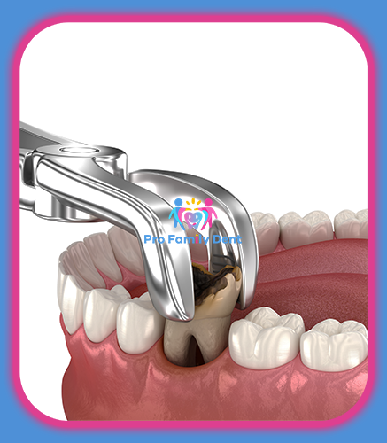 Chirurgie Dentara Targu Neamt Oferta Pret Pareri - Servicii Clinica Pro Family Dent