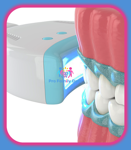 Tratament Albire Dentara LASER Targu Neamt Oferta Pret Pareri - Servicii Clinica Pro Family Dent
