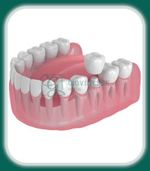 Coroane Protetica Dentara Iași Oferta Pret Pareri - Servicii Clinica Giovinesse Dental